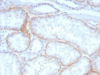 HAb18G Antibody / CD147 / Emmprin / Basigin