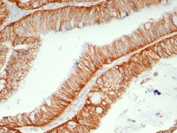 HAb18G Antibody / CD147 / Emmprin / Basigin