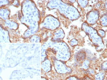EBI3 Antibody / Epstein-Barr virus induced 3