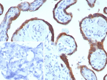 EBI3 Antibody / Epstein-Barr virus induced 3