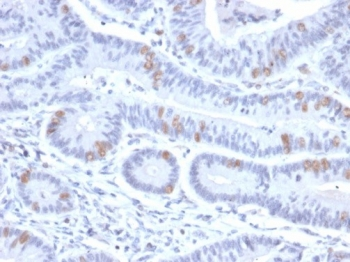 BRAF35 Antibody / HMG20B