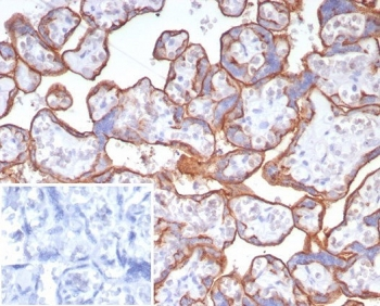 CD147 / Emmprin / Basigin Antibody