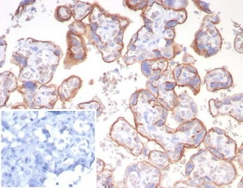 Emmprin Antibody / BSG / CD147