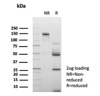 Emmprin Antibody / BSG / CD147