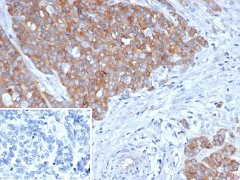 BRAF Antibody