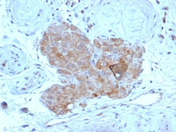 AMH Antibody / Anti-Muellerian Hormone