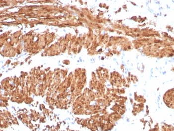 Calponin-1 Antibody