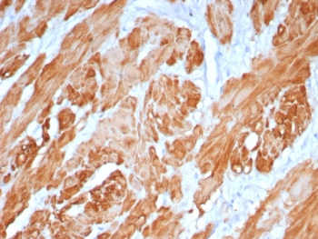 Calponin 1 Antibody