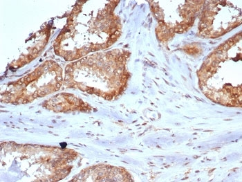 CARM1 Antibody / PRMT4