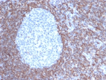Bcl-2 Antibody