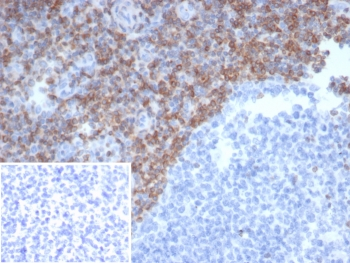 Bcl-2 Antibody