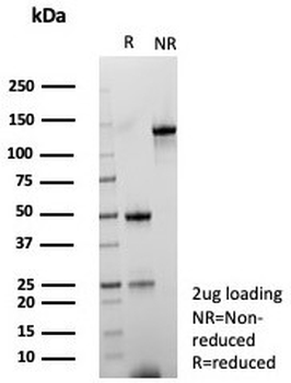 Bcl-2 Antibody