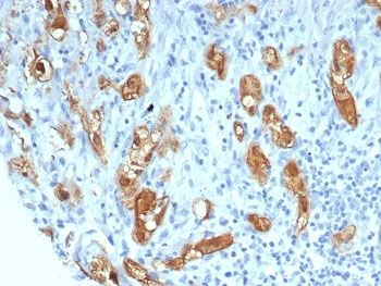SERPINB5 Antibody / MASPIN