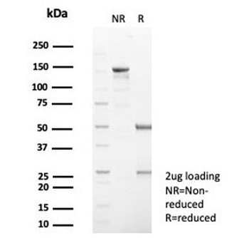 SERPINB5 Antibody / MASPIN
