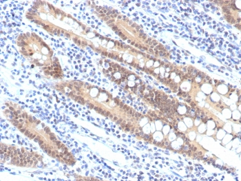 Recombinant SMAD4 Antibody
