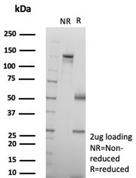 SMAD4 Antibody