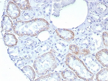 N-Cadherin Antibody / CDH2
