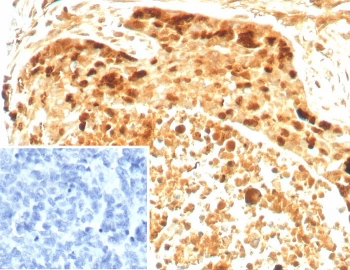 Survivin Antibody / BIRC5
