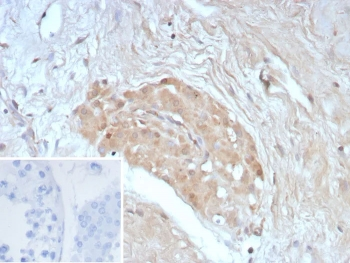 Survivin Antibody / BIRC5