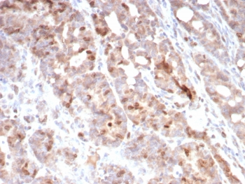 Survivin Antibody / BIRC5