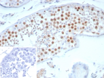 Survivin Antibody / BIRC5