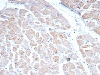 SSTR2 Antibody / Somatostatin Receptor 2