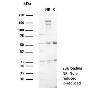 SSTR2 Antibody / Somatostatin Receptor 2