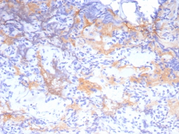 Growth Hormone Antibody / GH1