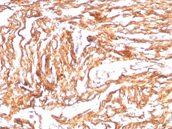N-Cadherin Antibody / CDH2