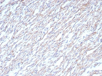 N-Cadherin Antibody / CDH2
