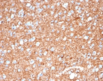 GFAP Antibody / Glial Fibrillary Acidic Protein