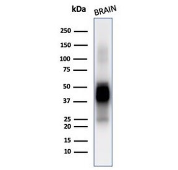 GFAP Antibody / Glial Fibrillary Acidic Protein
