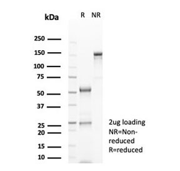 GFAP Antibody / Glial Fibrillary Acidic Protein