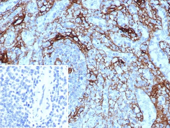 NGF Receptor Antibody / p75NTR / CD271