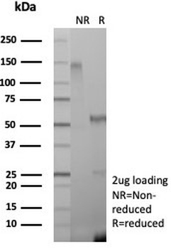 NGF Receptor Antibody / p75NTR / CD271