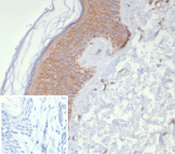 NME2 Antibody / Nucleoside diphosphate kinase B / NDKB