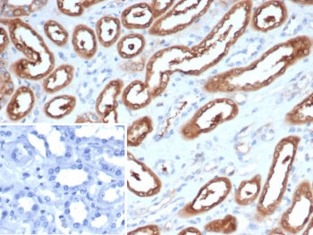 NME2 Antibody / Nucleoside diphosphate kinase B / NDKB