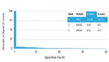 NME2 Antibody / Nucleoside diphosphate kinase B / NDKB