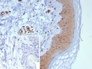 NME2 Antibody / Nucleoside diphosphate kinase B / NDKB