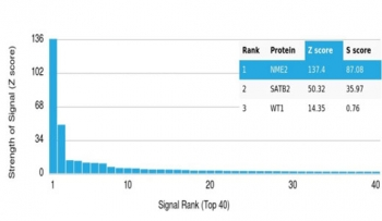 NME2 Antibody / Nucleoside diphosphate kinase B / NDKB