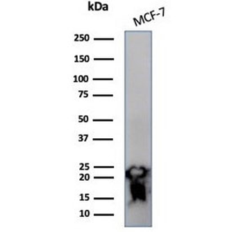 NME2 Antibody / Nucleoside diphosphate kinase B / NDKB
