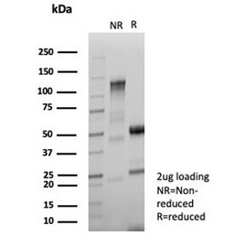 NME2 Antibody / Nucleoside diphosphate kinase B / NDKB