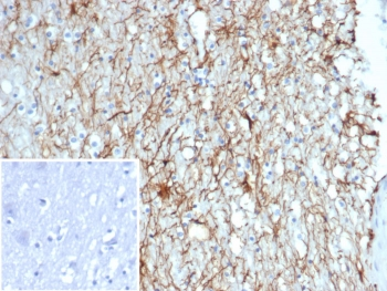 GFAP Antibody / Glial Fibrillary Acidic Protein