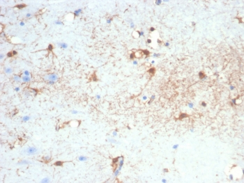 GFAP Antibody / Glial Fibrillary Acidic Protein