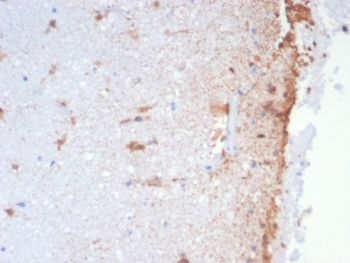 GFAP Antibody / Glial Fibrillary Acidic Protein