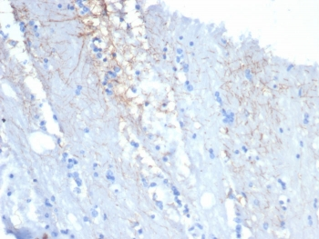 GFAP Antibody / Glial Fibrillary Acidic Protein