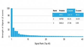NME2 Antibody / Nucleoside diphosphate kinase B / NDKB