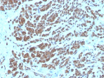NME2 Antibody / Nucleoside diphosphate kinase B / NDKB