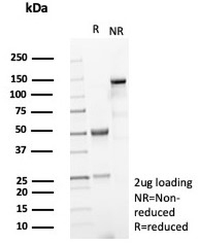 KRT15 Antibody / Cytokeratin 15