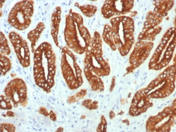 Acidic Cytokeratin Antibody (LMW / Type I)